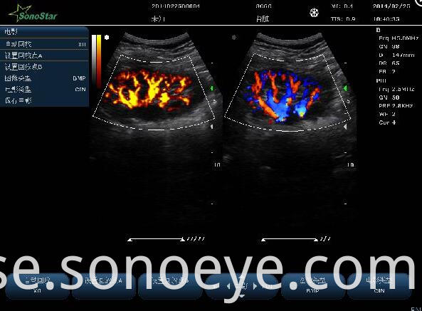 C10Pet Ultrasound Color Doppler